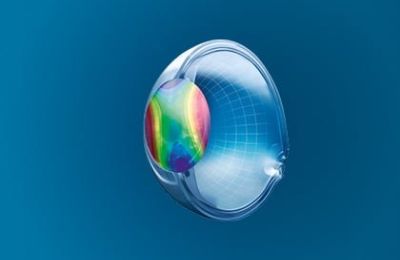 Rodenstock Biometrische Gläser Hornhauverkrümmung