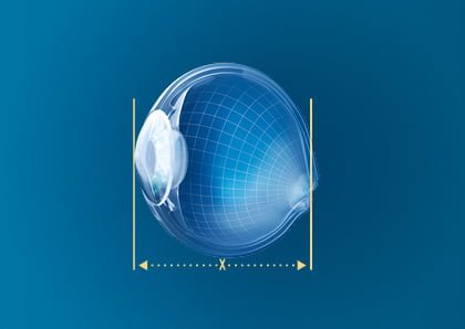 Rodenstock biometrische Gläser Augenlänge
