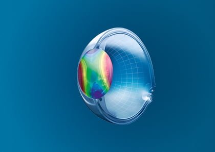 Rodenstock Biometrische Gläser Hornhauverkrümmung